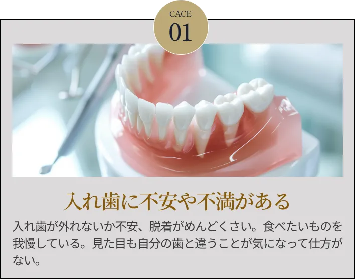 お悩み1 入れ歯の見た目が気になる
