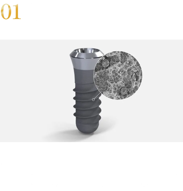 1:信頼性の高いインプラントのみを使用