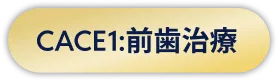 CASE1:前歯治療
